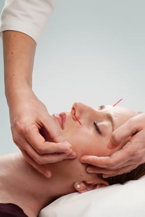 What Is Cosmetic Acupuncture?