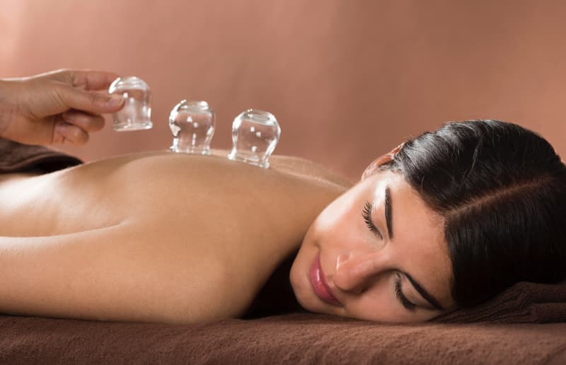 Cupping Therapy Session