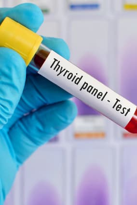 Diagnostic Testing For Thyroid