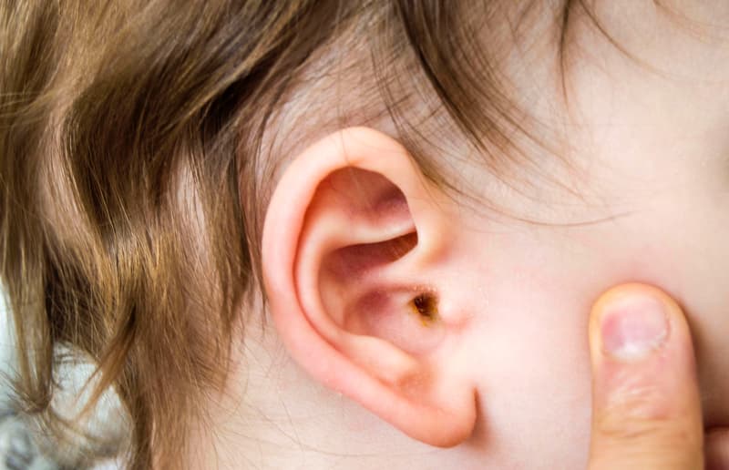 Ear Infections In Children