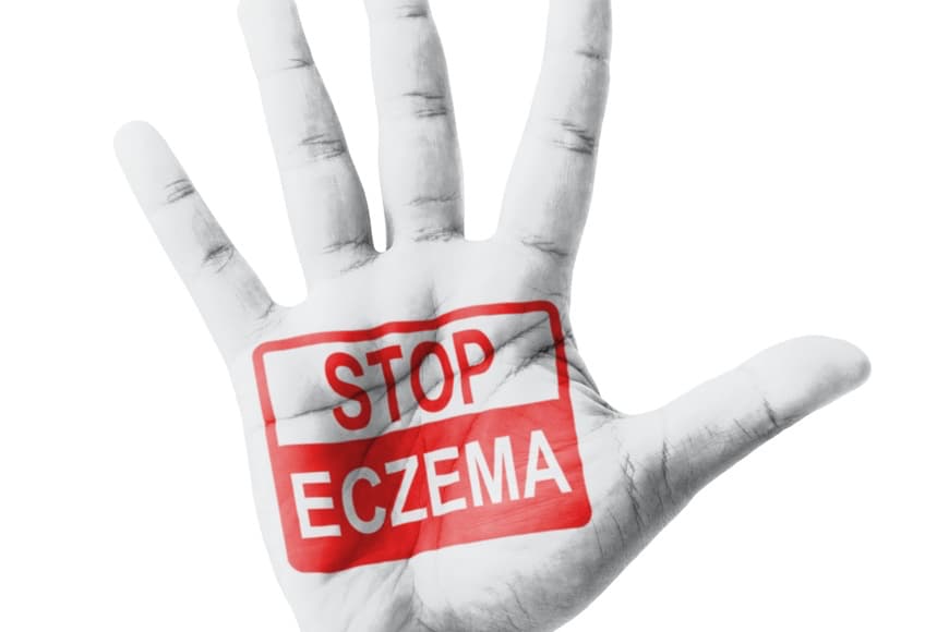 Treating Eczema With Kindness